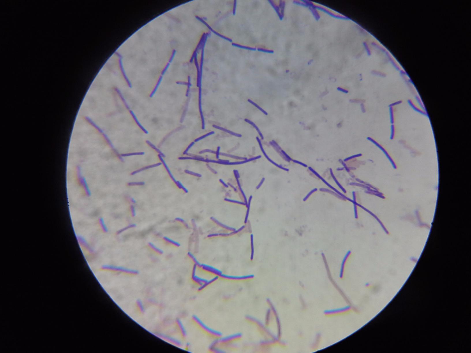 OMAX M82ES-SC100-LP100-OM 2000X LED Binocular Compound Lab Microscope customer photo 2