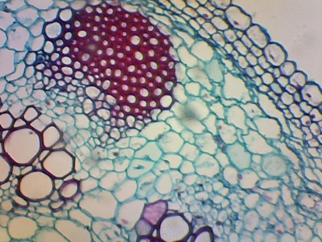 AmScope B120C-E1 LED Binocular Compound Microscope, 40X-2500X customer photo 2